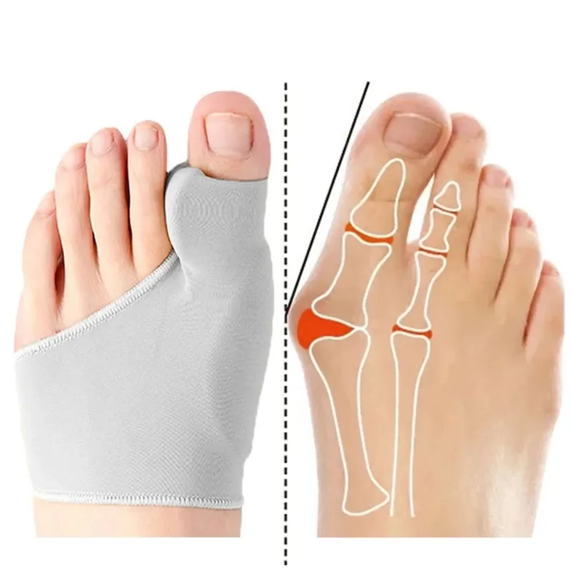 1/2 ペアつま先セパレーター外反母趾バニオンコレクター装具 - Ankle Brace Sock のレビューと価格