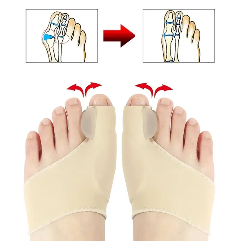 1/2 ペアつま先セパレーター外反母趾バニオンコレクター装具 - Ankle Brace Sock のレビューと価格